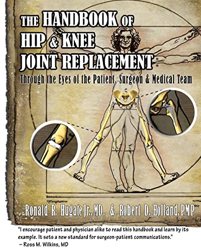 Imagen de archivo de Handbook of Hip & Knee Joint Replacement: Through the Eyes of the Patient, Surgeon & Medical Team a la venta por Wonder Book