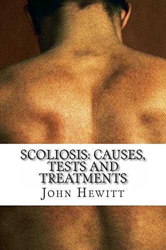 9781466335301: Scoliosis: Causes, Tests and Treatments