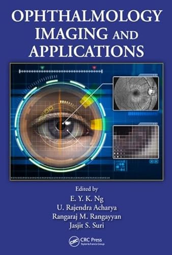 9781466559134: Ophthalmological Imaging and Applications