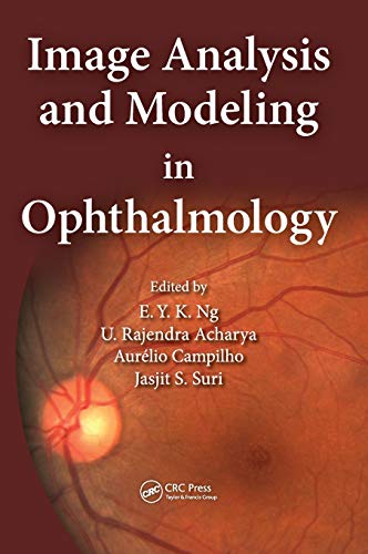 Stock image for Image Analysis and Modeling in Ophthalmology for sale by Chiron Media