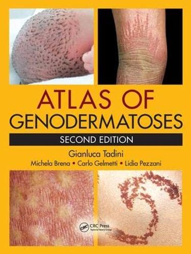 9781466598355: Atlas of Genodermatoses