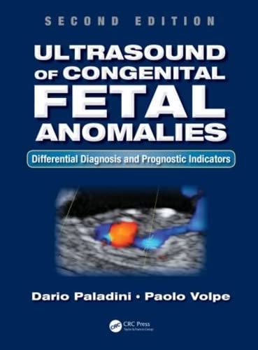 9781466598966: Ultrasound of Congenital Fetal Anomalies: Differential Diagnosis and Prognostic Indicators
