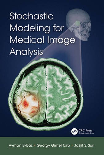 Stock image for Stochastic Modeling for Medical Image Analysis for sale by Chiron Media