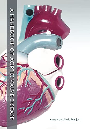 9781468546651: A Handbook Of Aortic Valve Disease