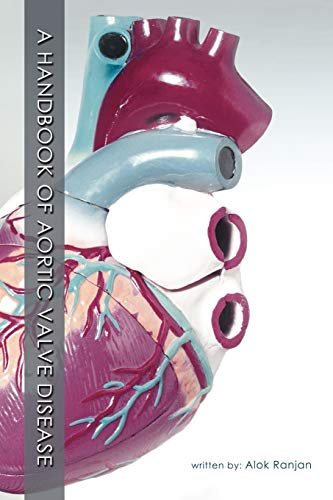 Imagen de archivo de A Handbook Of Aortic Valve Disease a la venta por PBShop.store US