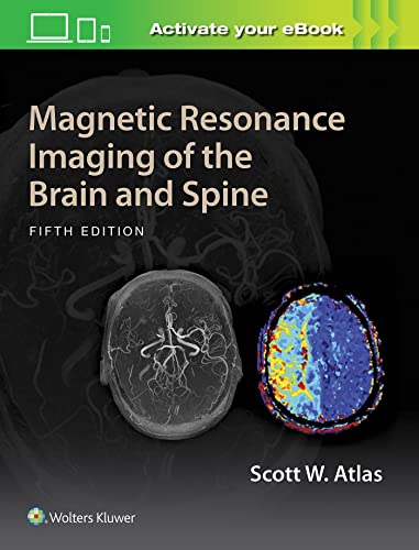 Imagen de archivo de Magnetic Resonance Imaging of the Brain and Spine a la venta por Scubibooks