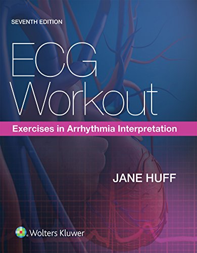 Stock image for ECG Workout: Exercises in Arrhythmia Interpretation for sale by SecondSale