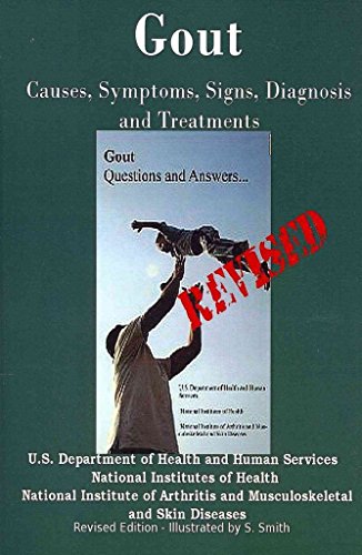 9781469967509: Gout: Causes, Symptoms, Signs, Diagnosis and Treatments - Revised Edition - Illustrated by S. Smith
