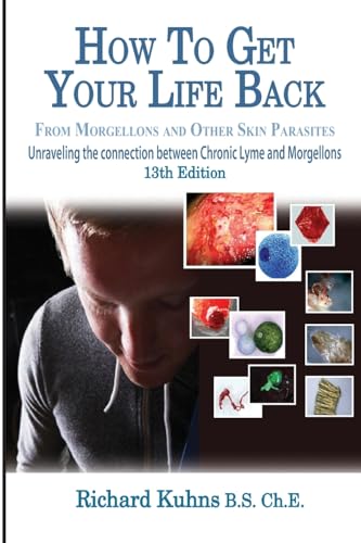 Stock image for How to Get Your Life Back From Morgellons and Other Skin Parasites Limited Edit for sale by SecondSale