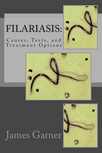 Imagen de archivo de Filariasis: Causes, Tests, and Treatment Options a la venta por Save With Sam