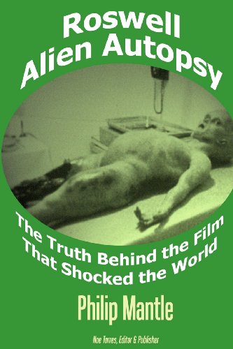 Roswell Alien Autopsy: The Truth Behind The Film That Shocked The World