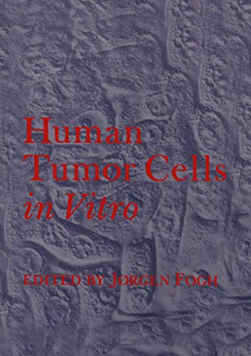 Stock image for Human Tumor Cells in Vitro for sale by Lucky's Textbooks