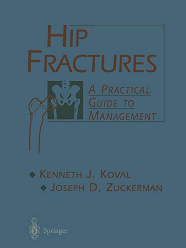 9781475740547: Hip Fractures: A Practical Guide To Management