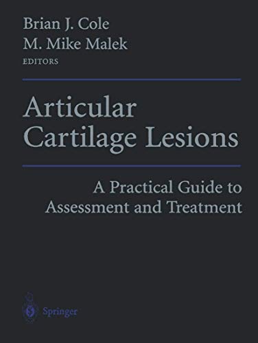 9781475792898: Articular Cartilage Lesions: A Practical Guide to Assessment and Treatment