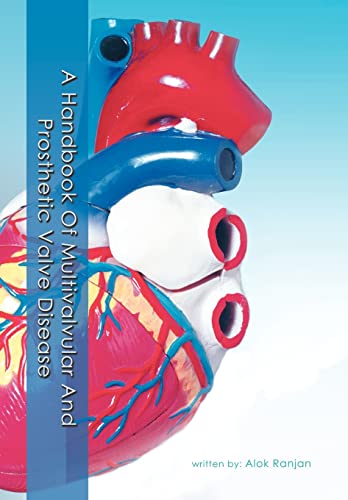 9781477292419: A Handbook Of Multivalvular and Prosthetic Valve Disease