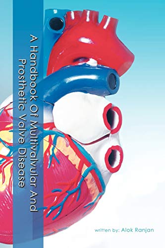 Imagen de archivo de A Handbook Of Multivalvular and Prosthetic Valve Disease a la venta por PBShop.store US