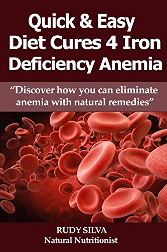 Stock image for Anemia: Iron Deficiency Diet: Anemia: Iron Deficiency for sale by Zoom Books Company