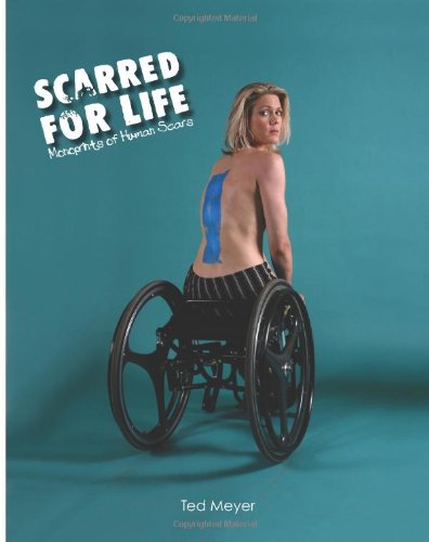 Stock image for Scarred for Life: Mono-prints and documentation of human scars for sale by Kona Bay Books