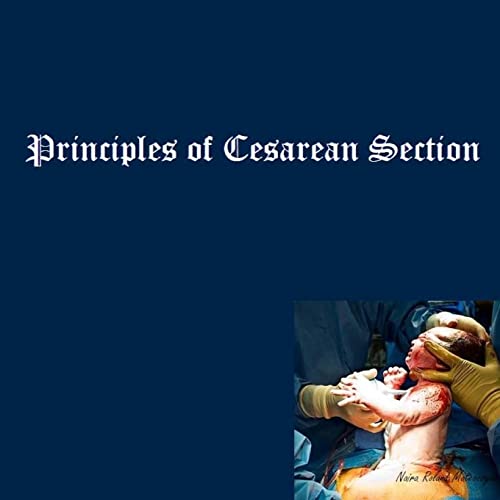 Beispielbild fr Principles of Cesarean Section zum Verkauf von Lucky's Textbooks