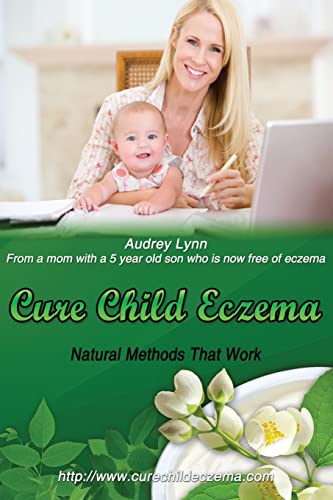 Beispielbild fr Cure Child Eczema: Natural Methods That Work zum Verkauf von Redux Books