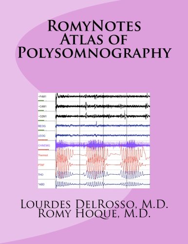 Stock image for RomyNotes Atlas of Polysomnography for sale by Revaluation Books