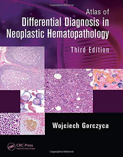 9781482212211: Atlas of Differential Diagnosis in Neoplastic Hematopathology, Third Edition