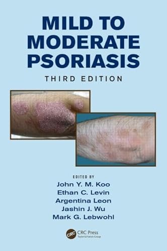 Beispielbild fr Mild To Moderate Psoriasis 3Ed (b 2014) zum Verkauf von Books From California