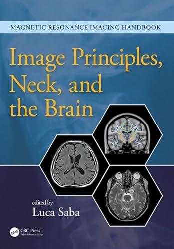 9781482216134: Image Principles, Neck, and the Brain (Magnetic Resonance Imaging Handbook)