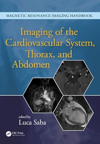 Beispielbild fr Imaging of the Cardiovascular System, Thorax, and Abdomen (Magnetic Resonance Imaging Handbook) zum Verkauf von BooksRun