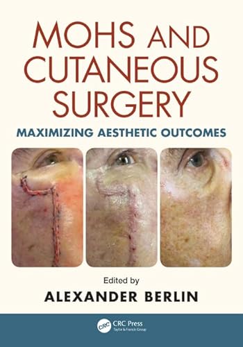 9781482221367: Mohs and Cutaneous Surgery: Maximizing Aesthetic Outcomes