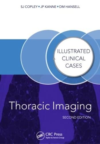 9781482231151: Thoracic Imaging: Illustrated Clinical Cases, Second Edition