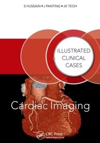 Beispielbild fr Cardiac Imaging zum Verkauf von Blackwell's