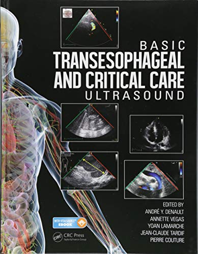 Beispielbild fr Basic Transesophageal and Critical Care Ultrasound zum Verkauf von Reuseabook