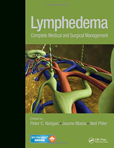 9781482241099: Lymphedema: Complete Medical and Surgical Management