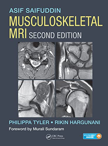 9781482247800: Musculoskeletal MRI