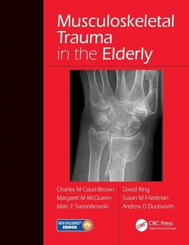 Imagen de archivo de Musculoskeletal Trauma in the Elderly a la venta por ThriftBooks-Dallas