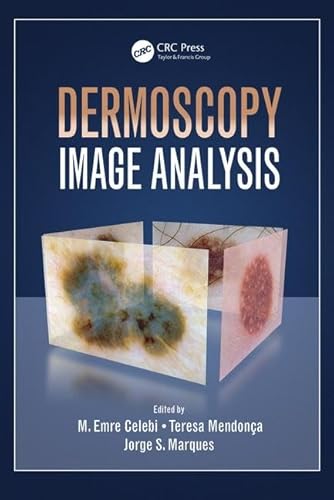 Stock image for Dermoscopy Image Analysis for sale by ThriftBooks-Dallas