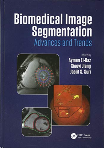 Imagen de archivo de Biomedical Image Segmentation : Advances And Trends a la venta por Basi6 International