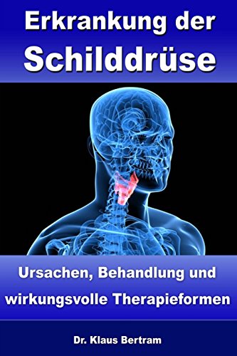 Stock image for Erkrankung der Schilddrse: Ursachen, Behandlung und wirkungsvolle Therapieformen for sale by medimops