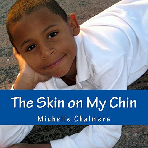 Stock image for The Skin on My Chin for sale by Better World Books