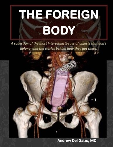 

The Foreign Body: A collection of the most interesting X-rays of things that dont belong and the stories behind how they got there!