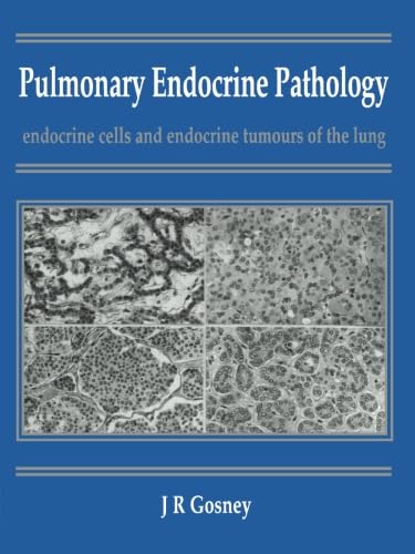 Stock-Bild f�r Pulmonary Endocrine Pathology: Endocrine Cells and Endocrine Tumours of the Lung