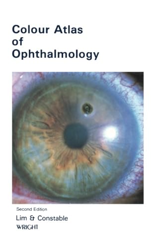 Stock image for Colour Atlas of Ophthalmology: Second Edition for sale by Revaluation Books