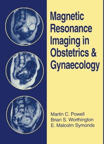 Imagen de archivo de Magnetic Resonance Imaging in Obstetrics and Gynaecology a la venta por Revaluation Books