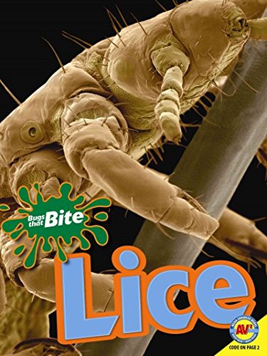 9781489607706: Lice (Bugs That Bite)