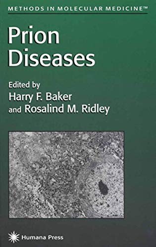 Immagine dell'editore per Prion Diseases (Methods in Molecular Medicine, 3) venduto da Ria Christie Collections