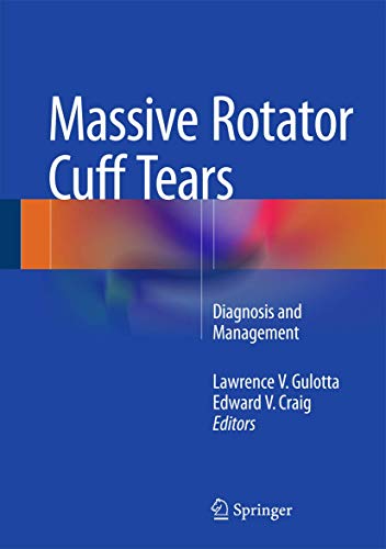 Beispielbild fr Massive Rotator Cuff Tears. Diagnosis and Management. zum Verkauf von Antiquariat im Hufelandhaus GmbH  vormals Lange & Springer