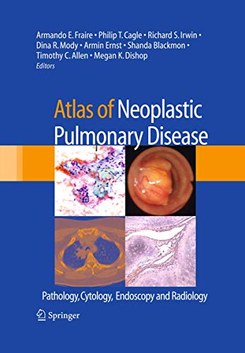9781489979063: Atlas of Neoplastic Pulmonary Disease: Pathology, Cytology, Endoscopy and Radiology
