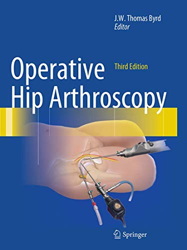 9781489986412: Operative Hip Arthroscopy