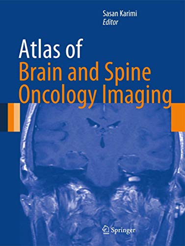 9781489992215: Atlas of Brain and Spine Oncology Imaging (Atlas of Oncology Imaging)